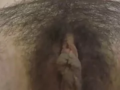 Hairy anna